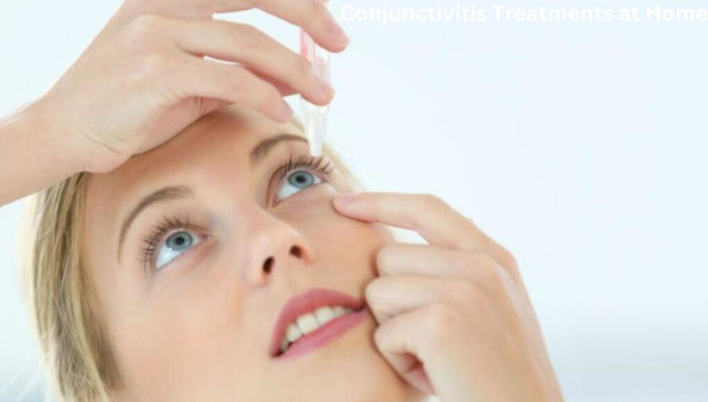 Conjunctivitis Treatments at Home